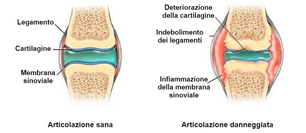 arthro sanyx crema