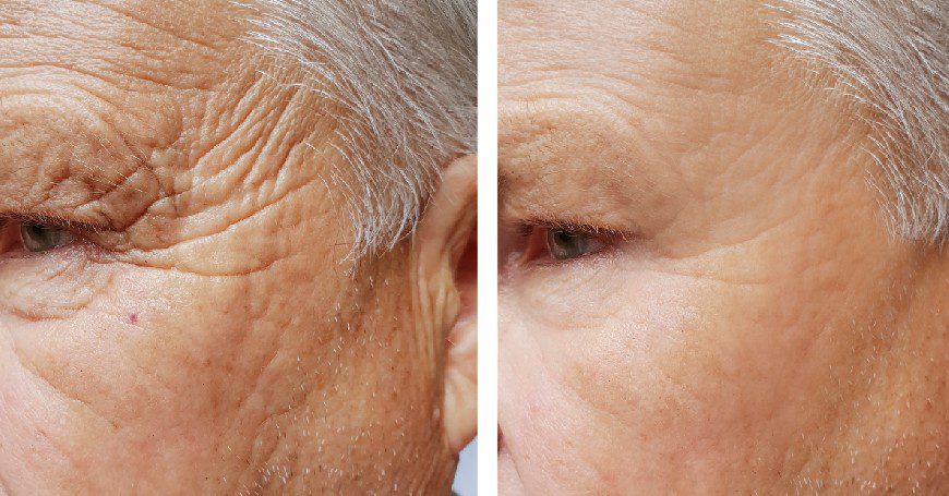 Energyskin illumineface anti rughe funziona