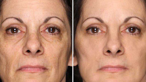 energyskin e illumineface recensioni italia