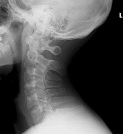 Cuscino per dolori cervicali