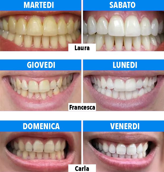 Instant Smile funziona?
