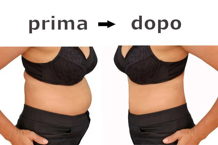Crema snellente Keto Lipox dimagrire velocemente senza sforzo