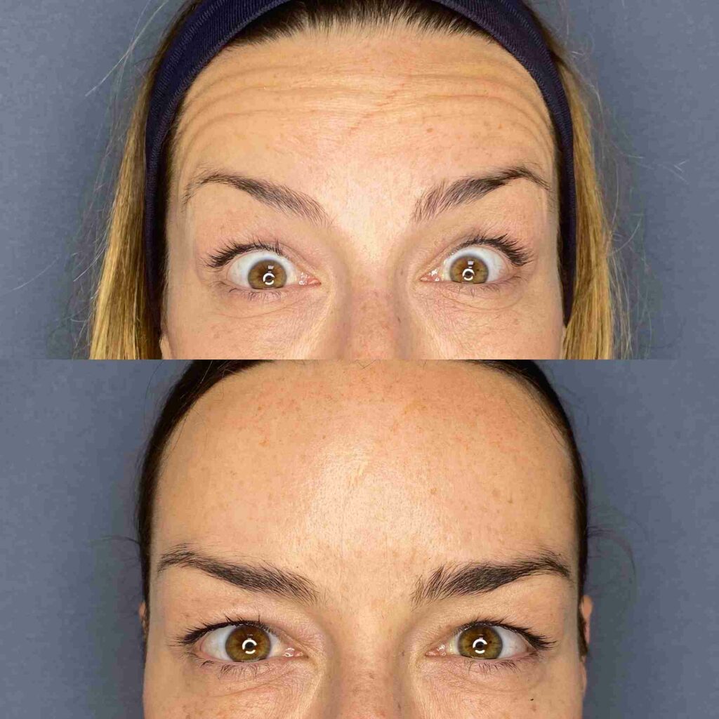 Crio Viso - Maschera Viso Effetto Freddo truffa
