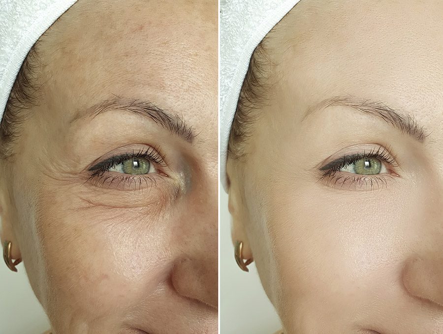 Collagen Pept 2x1 testimonianze