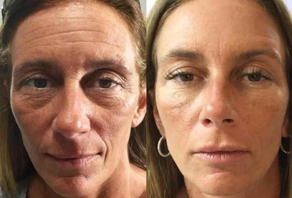 Luma Viso - Crema Viso con Bava di Lumaca truffa