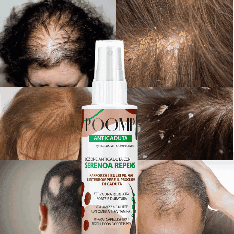 POOMP LOZIONE ANTICADUTA calvizia alopecia