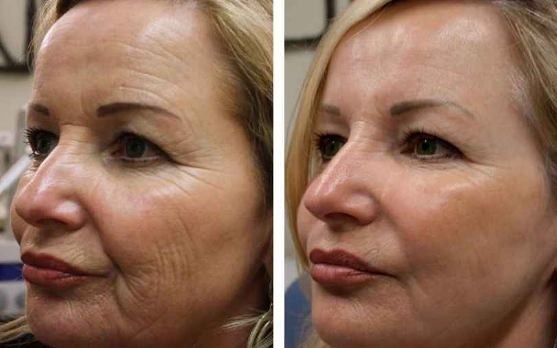 Luma Viso - Crema Viso con Bava di Lumaca truffa