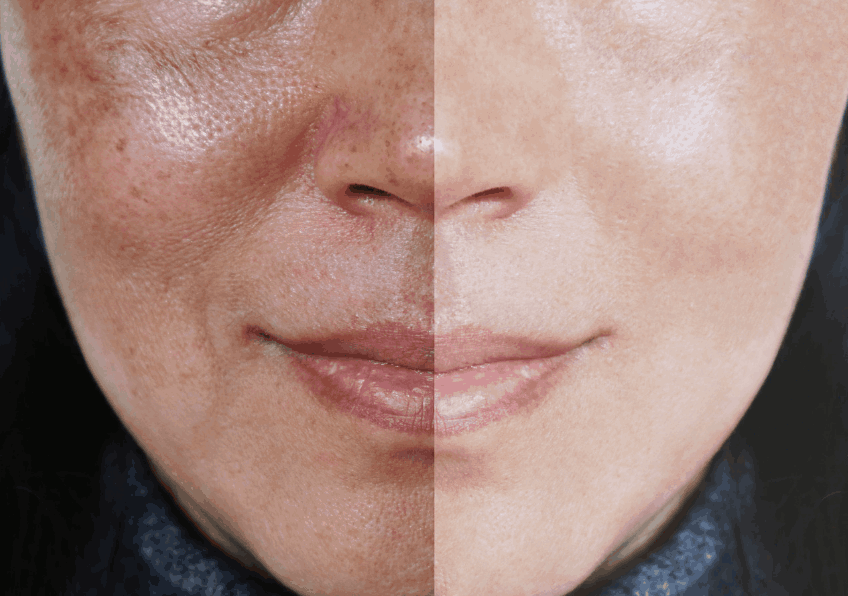 Zima Viso - Crema Viso con Coenzima Q10 pelle perfetta