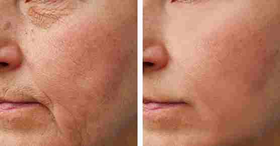 Luma Viso - Crema Viso con Bava di Lumaca recensioni